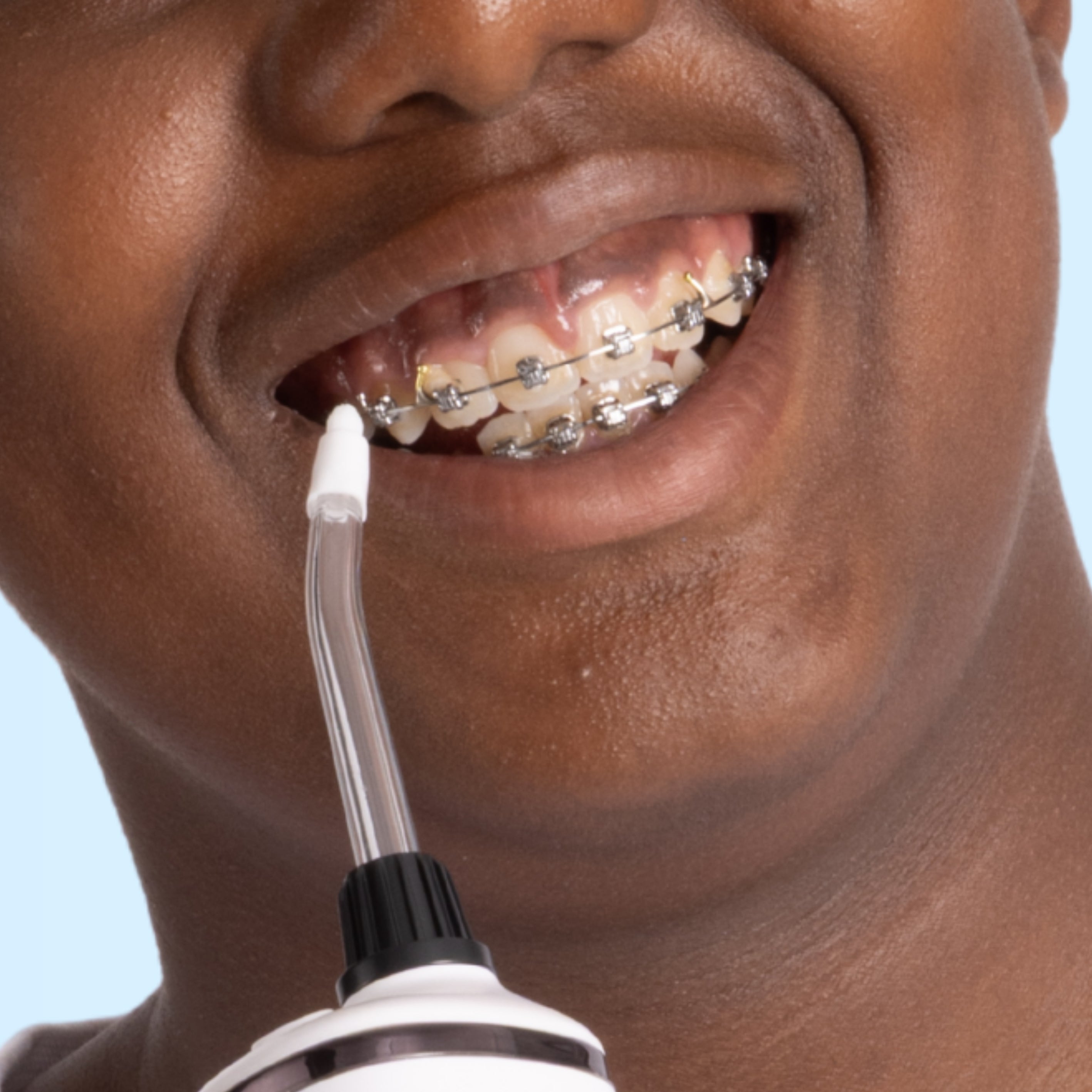 Canule orthodontique pour jet dentaire