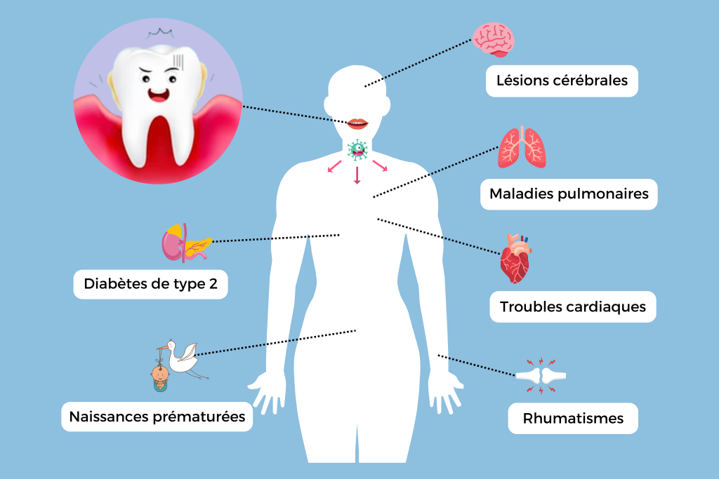 Les 10 idées reçues sur le saignement des gencives 1 - Neopulse 47